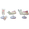 Dentes Molares Modell / Dentes Decidui Modell / Dentes Permanentes Modell